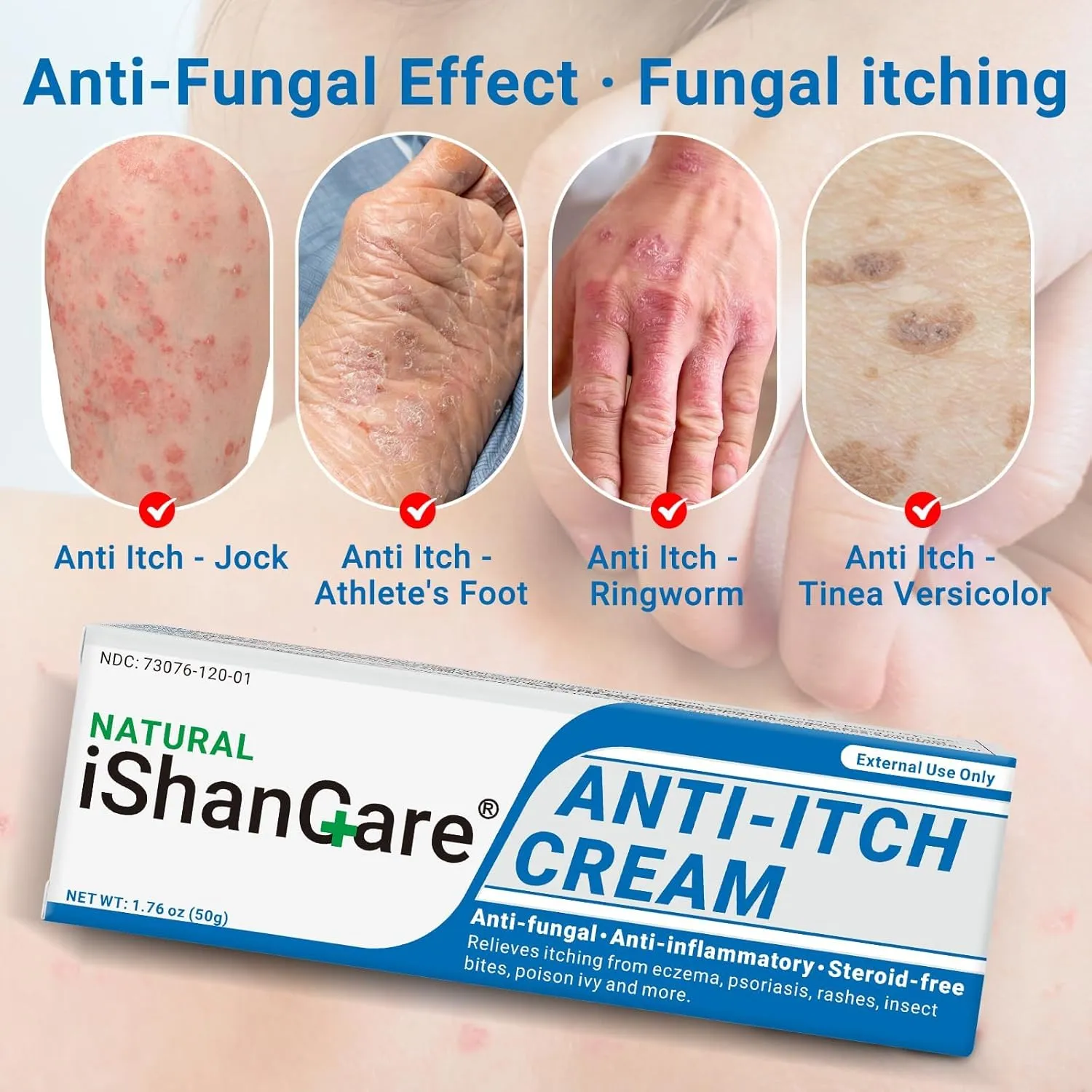 Anti Itch Soothing Cream Extra Strength Skin Itch Relief Ointment, for Full Body Itching Caused by Seasonal Changes, Dermatitis, Eczema, Rash, Psoriasis, Hives, Bites, Poison Ivy, 1.76 oz