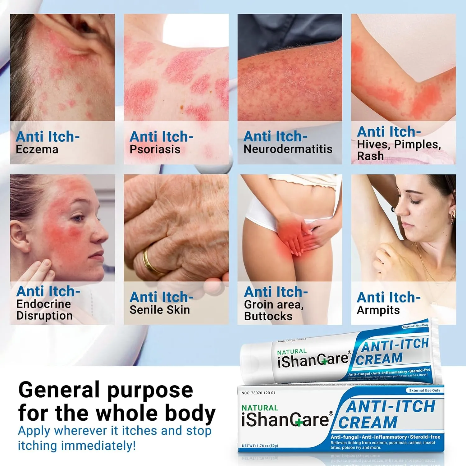 Anti Itch Soothing Cream Extra Strength Skin Itch Relief Ointment, for Full Body Itching Caused by Seasonal Changes, Dermatitis, Eczema, Rash, Psoriasis, Hives, Bites, Poison Ivy, 1.76 oz