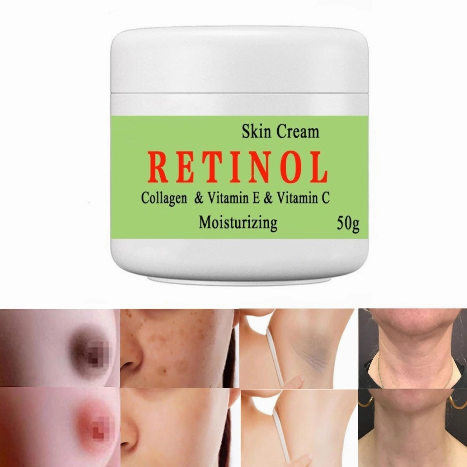Cremas Para Las Manchas de La Cara, 50g Cremas para quitar manchas de la cara Vitamin C&E Face Moisturizer Cream, Crema para manchas oscuras en la piel (1pcs)