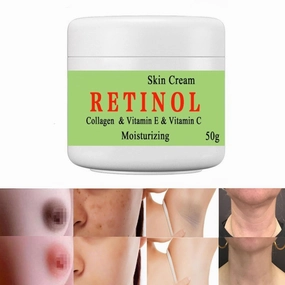 Cremas Para Las Manchas de La Cara, 50g Cremas para quitar manchas de la cara Vitamin C&E Face Moisturizer Cream, Crema para manchas oscuras en la piel (1pcs)
