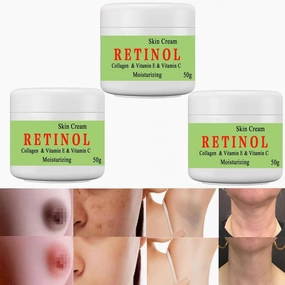 Cremas Para Las Manchas de La Cara, 50g Vitamin C&E Face Moisturizer Cream, Adecuado para varias áreas como cara, axilas, cuello, zona privade (3pcs)