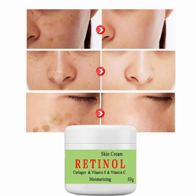 Cremas Para Las Manchas de La Cara, 50g Vitamina C&E para la cara mujer, Face Moisturizer Cream, Adecuado para varias áreas como cara, axilas, cuello, zona privade (2pcs)