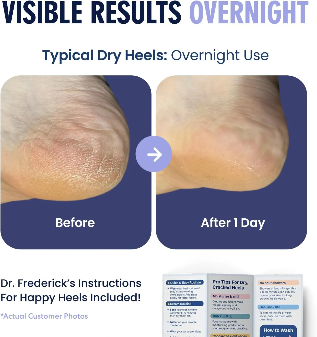 Dr. Frederick's Original Moisturizing Fuzzy Heel Socks - 2 Pairs - Cozy Gel-Lined Sleep Socks for Women & Men - Soothes Dry, Cracked Feet - Heel Repair - Lavender Luxury
