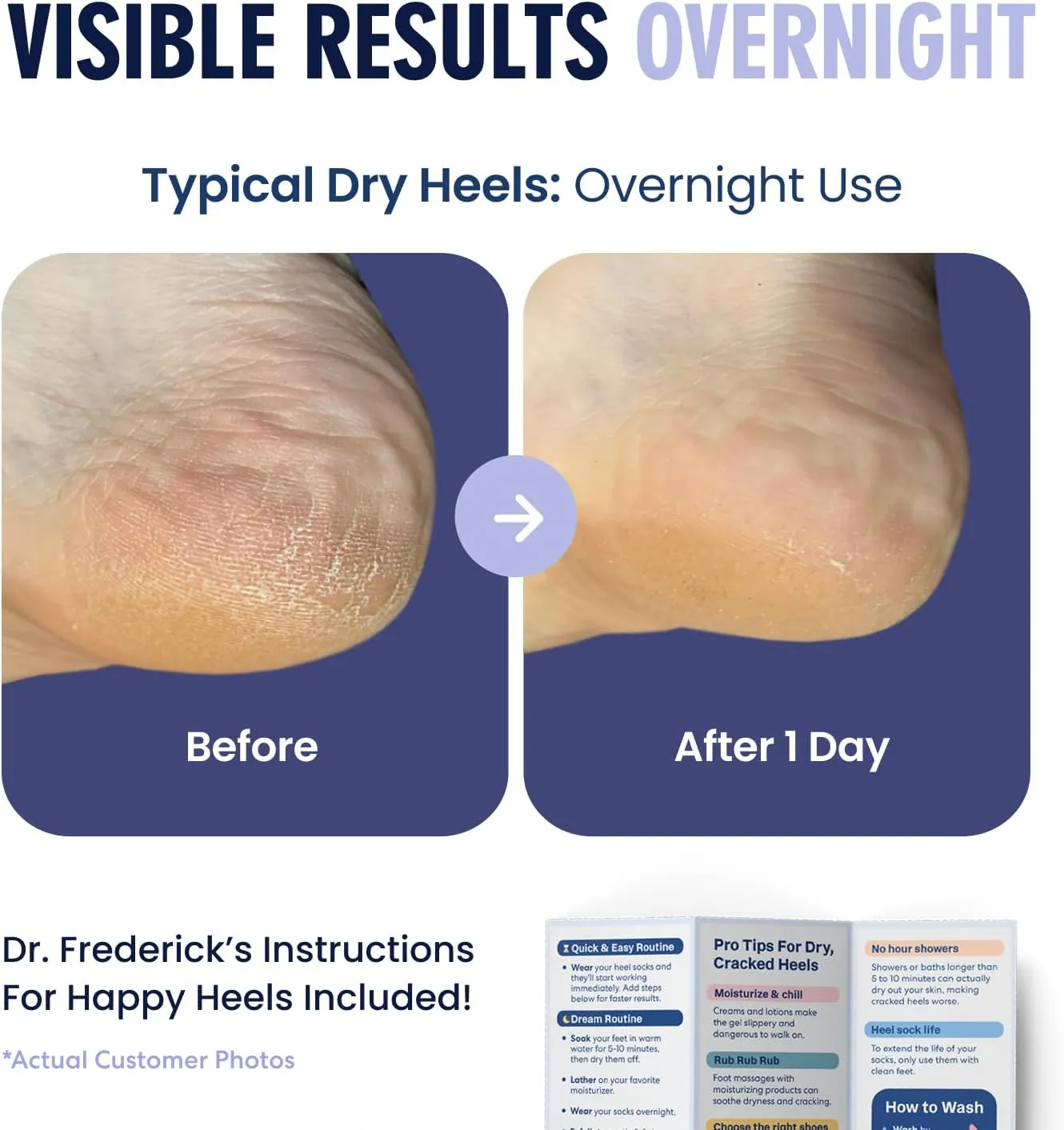 Dr. Frederick's Original Moisturizing Fuzzy Heel Socks - 2 Pairs - Cozy Gel-Lined Sleep Socks for Women & Men - Soothes Dry, Cracked Feet - Heel Repair - Lilac Leisure