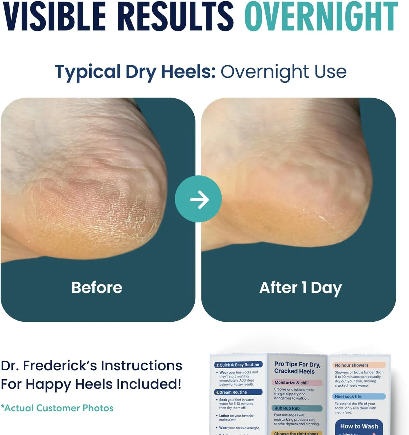 Dr. Frederick's Original Moisturizing Fuzzy Heel Socks - 2 Pairs - Cozy Gel-Lined Sleep Socks for Women & Men - Soothes Dry, Cracked Feet - Heel Repair - Teal Tranquility