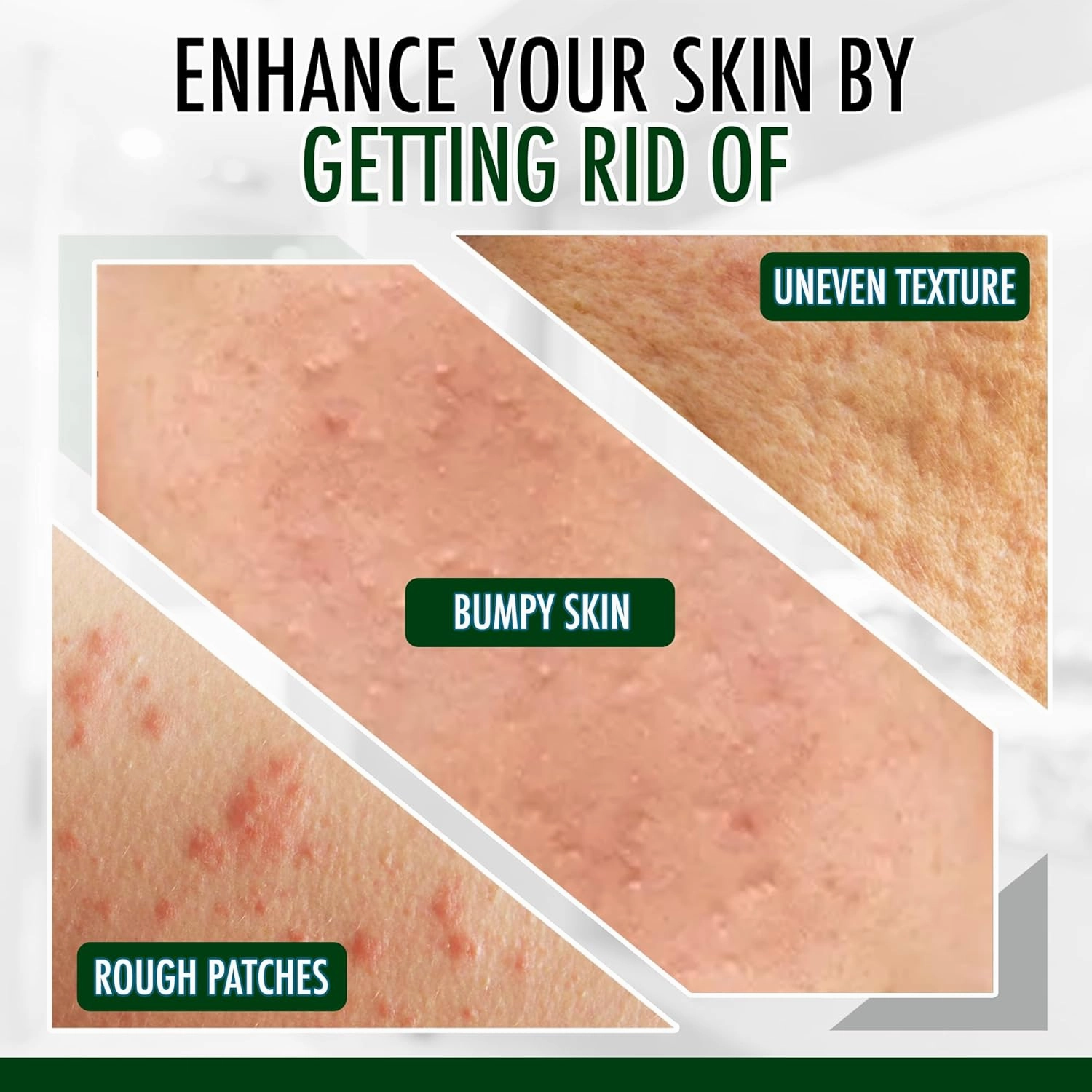 GLY MIRACLE Moisturizing Body Cream Lotion, 16 ounce - Non-Greasy Skin Humectant for Extremely Dry Skin, Hands, Body, and Feet, Fragrance-Free with Pure Glycerin for Nourishing Hydration.