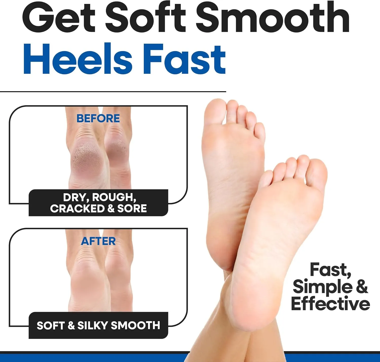 Moisturizing Socks for Men | Cracked Heel Treatment with Aloe Vera | Moisturizer Foot Callus Remover | Aloe Socks for Cracked Heels & Dry Cracked Feet | Lotion Infused Gel Heel Socks (XL - 3 Pairs)