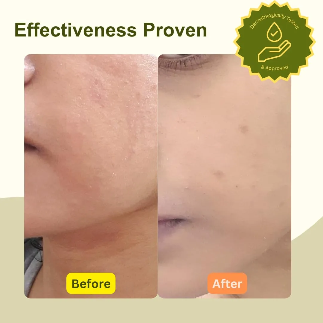 Mugwort Skin Oil - Infused Facial & Body Oil - Moisturizing Face Oil, or Dry Skin, Eczema, Psoriasis, Natural, Lightweight, Unisex - Unscented 100% Natural