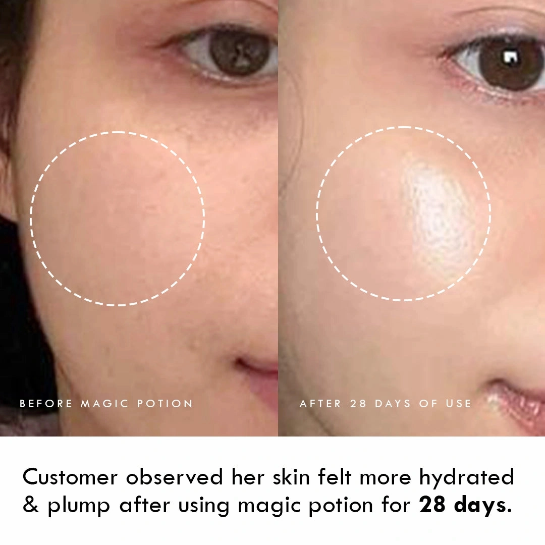 Oil Control Mattifying Gel - MAGIC POTION