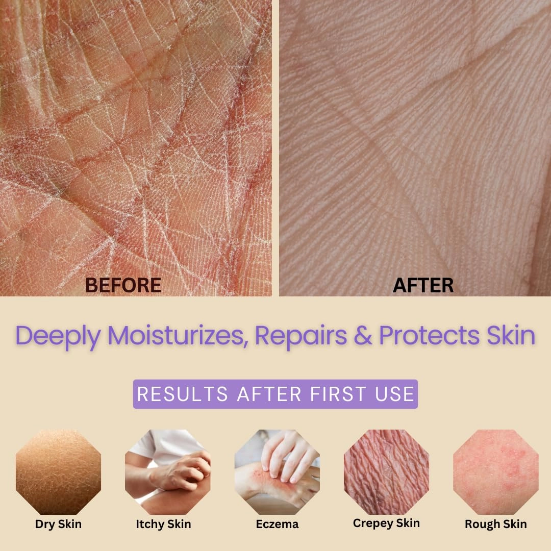 Soothing Lavender Essential Oil Body Lotion & Hand Cream - Natural Moisturizer for Dry Skin with Ceramides, Vitamins & Olive, Coconut, Avocado Oils - Organic Lotion for Women & Men 8oz