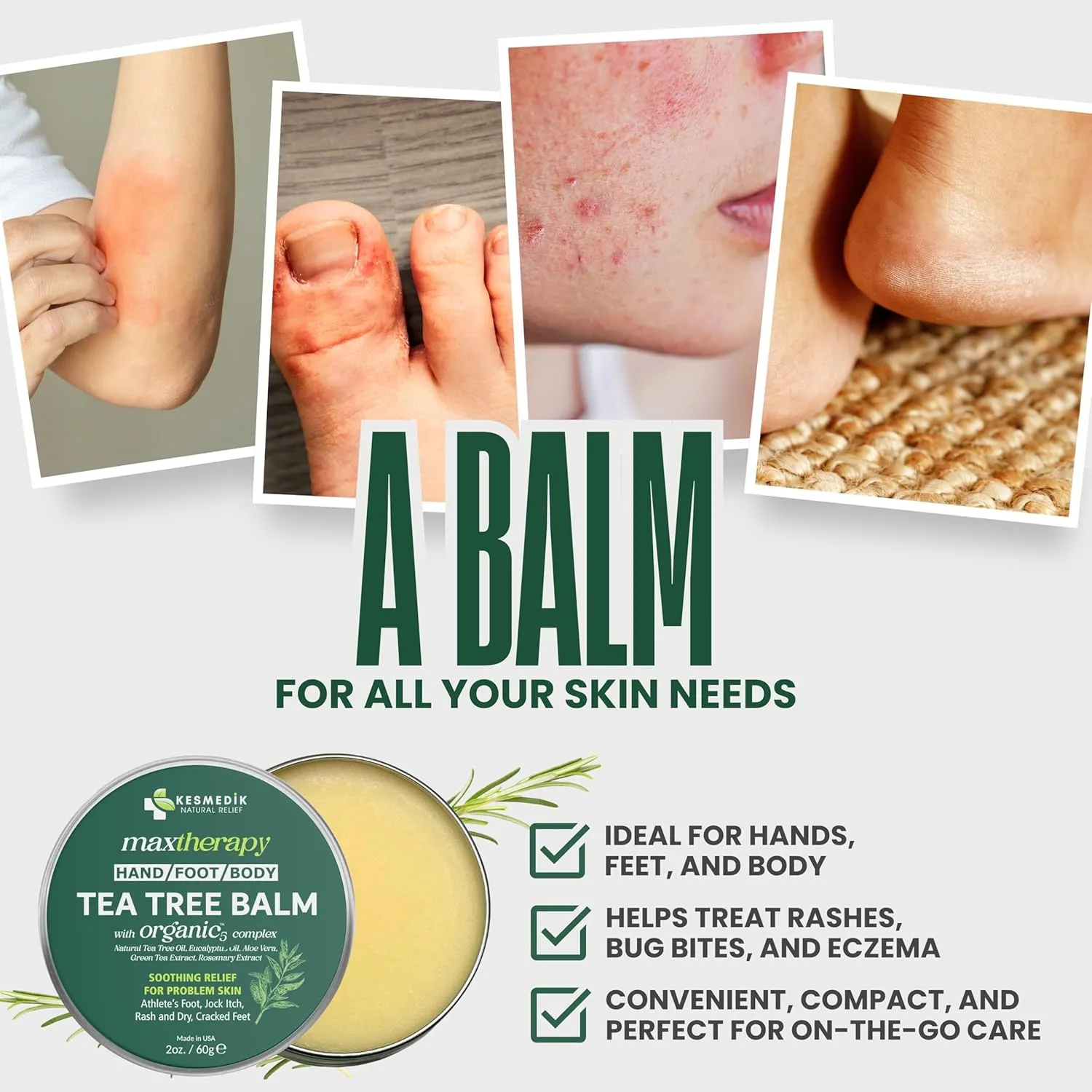Tea Tree Oil Balm MaxTherapy | Antifungal Homeopathic Remedy for Feet, Scalp & Body, Soothes Itchy Skin, Diaper Rash, Softens Dryness & Cracked Skin (1-Pack)