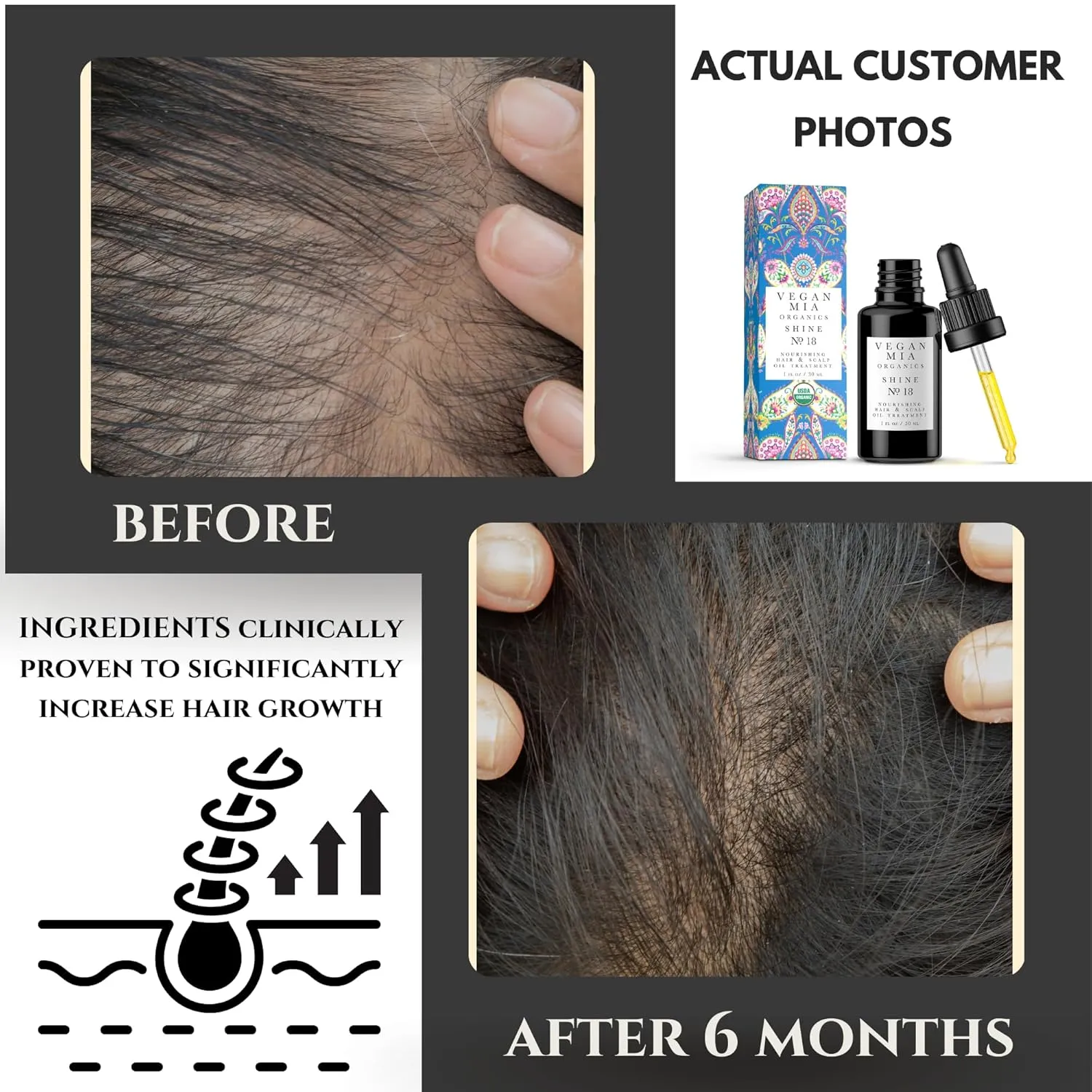 USDA Organic Rosemary Oil for Hair Growth & Intense Nourishment with Castor, Jojoba, Argan, Amla & More Dandruff & Dry Scalp Treatment | Get Healthier, Shiny Hair Naturally, 1 fl oz